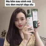 Shop sỉ combo bộ dầu gội xả Weilaiya mọc tóc chiết xuất gừng xả