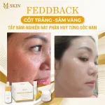 Chỗ sỉ combo Kem Face Sâm Vàng MQ Skin