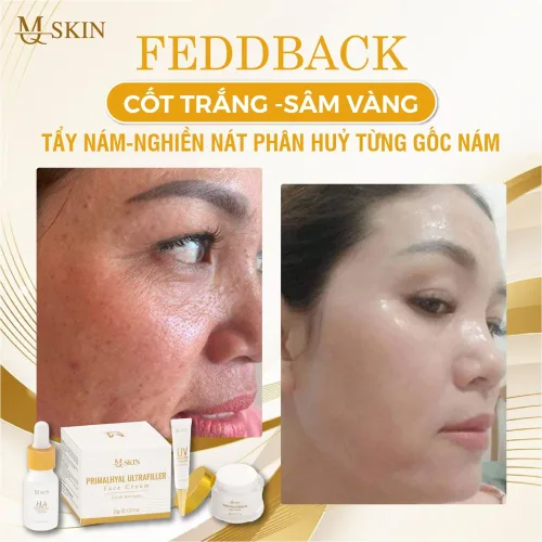 Chỗ sỉ combo Kem Face Sâm Vàng MQ Skin