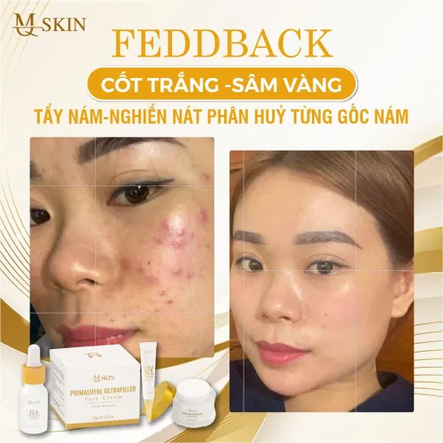 Chỗ sỉ combo Kem Face Sâm Vàng MQ Skin