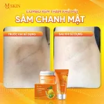 Nơi lấy sỉ combo Kem Tẩy Lông + Kem Thâm Nách MQ Skin Sâm Chanh Mật
