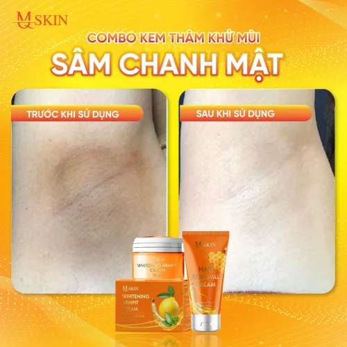 Nơi lấy sỉ combo Kem Tẩy Lông + Kem Thâm Nách MQ Skin Sâm Chanh Mật