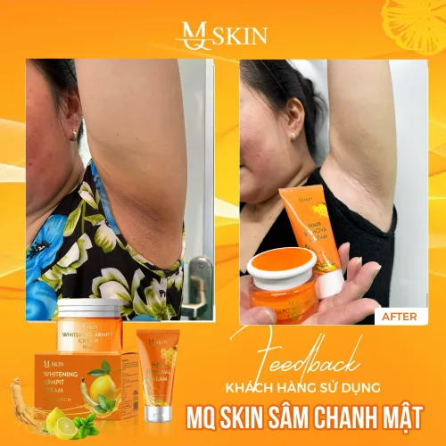 Nơi lấy sỉ combo Kem Tẩy Lông + Kem Thâm Nách MQ Skin Sâm Chanh Mật