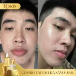 Bộ Serum 80ml và Bột Rửa Mặt Sâm Vàng MQ Skin
