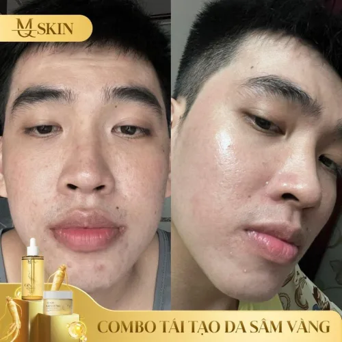 Bộ Serum 80ml và Bột Rửa Mặt Sâm Vàng MQ Skin