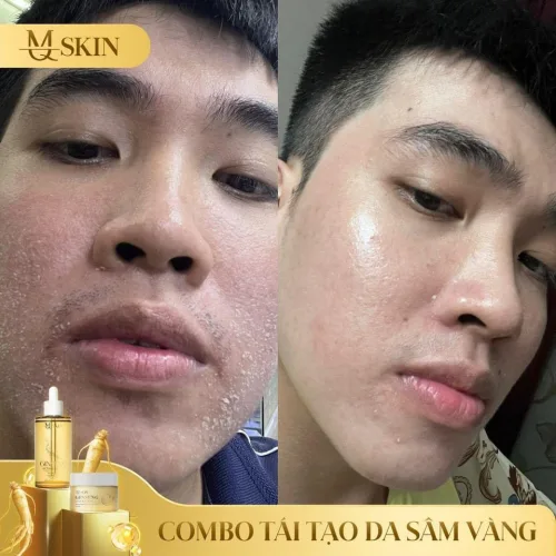 Bộ Serum 80ml và Bột Rửa Mặt Sâm Vàng MQ Skin