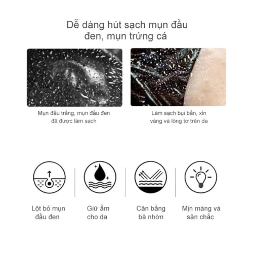Nguồn hàng sỉ gel Lột Mụn Nha Đam Okeshop Acne Removal Gel 30g