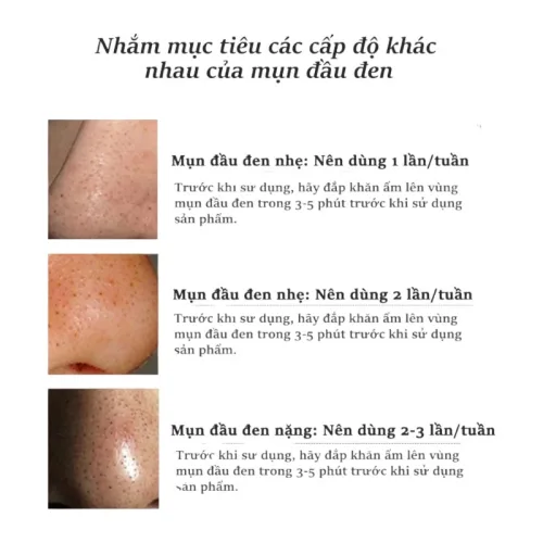 Nguồn hàng sỉ gel Lột Mụn Nha Đam Okeshop Acne Removal Gel 30g
