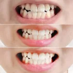 Nguồn hàng sỉ kem Đánh Răng Median Màu Đỏ Dental IQ 93% Tartar Toothpaste Badbreath 120g