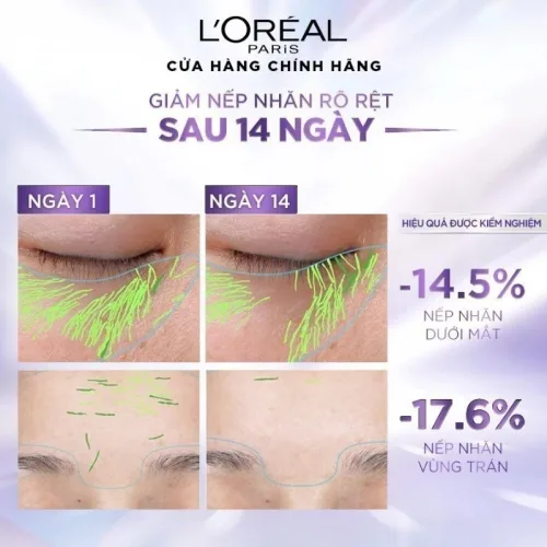 Nguồn hàng sỉ kem Dưỡng Siêu Cấp Ẩm Loreal Paris Revitalift Hyaluronic Acid Line Filling Water 50ml