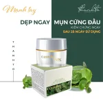 Shop sỉ kem Face Mụn Rau Má Jiuhe Centella Acne Thanh Tô Cosmetics 10g