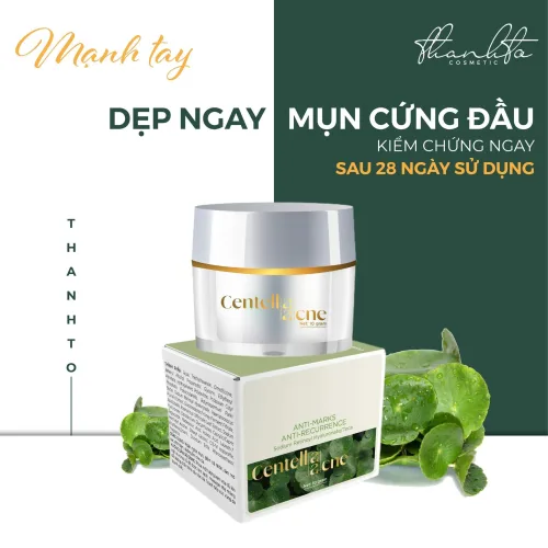 Shop sỉ kem Face Mụn Rau Má Jiuhe Centella Acne Thanh Tô Cosmetics 10g