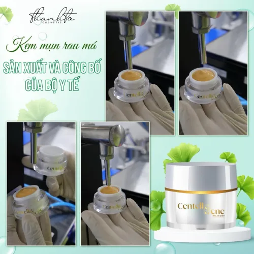Shop sỉ kem Face Mụn Rau Má Jiuhe Centella Acne Thanh Tô Cosmetics 10g