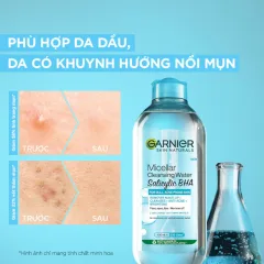 Garnier Micellar Salicylic BHA Nắp Xanh 400ml Cho Da Dầu Mụn
