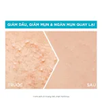 Nơi lấy sỉ serum Garnier Giảm Mụn Sáng Da Skin Naturals Bright Complete Anti-Acne Booster Serum 30ml