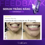 Tinh chất Unismile Unikare dạng nhỏ giọt 10ml cho răng