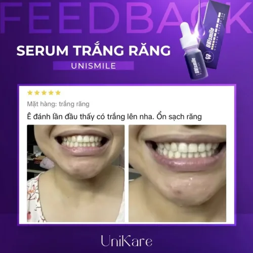 Tinh chất Unismile Unikare dạng nhỏ giọt 10ml cho răng