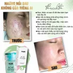 Serum giảm mụn Jiuhe Acne Extra 5ml của Thanh Tô Cosmetics