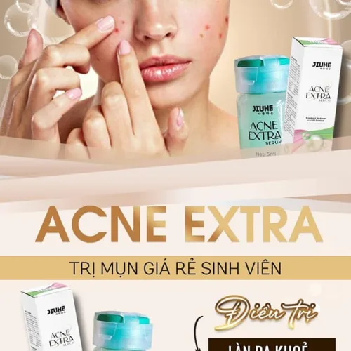 Serum giảm mụn Jiuhe Acne Extra 5ml của Thanh Tô Cosmetics
