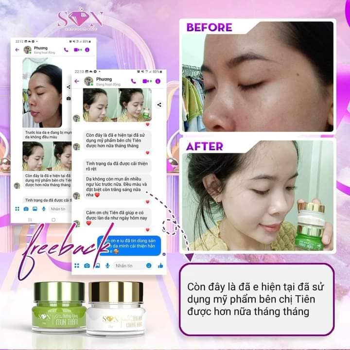 Combo Kem Dưỡng Trắng Da, Giảm Mụn  son Cosmetic Tặng Kèm Cao Bưởi Loại Bỏ Thâm Sạm Se Khít Lỗ Chân Lông