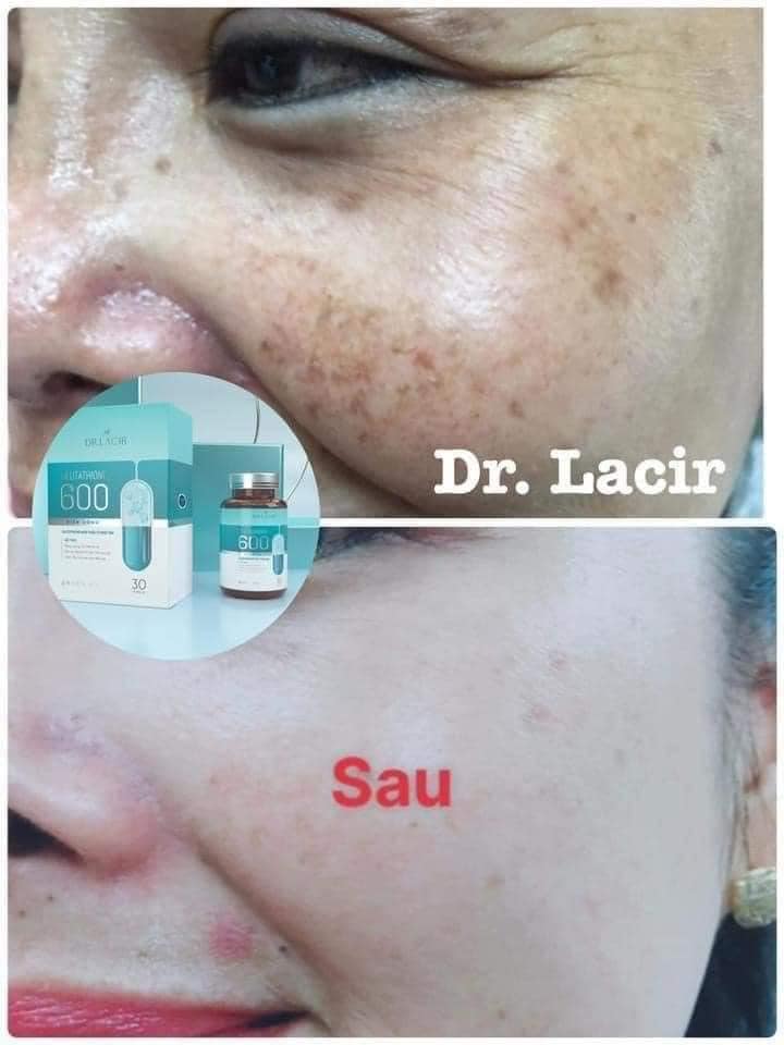 Viên Uống Trắng Da Glutathione 600 Dr Lacir