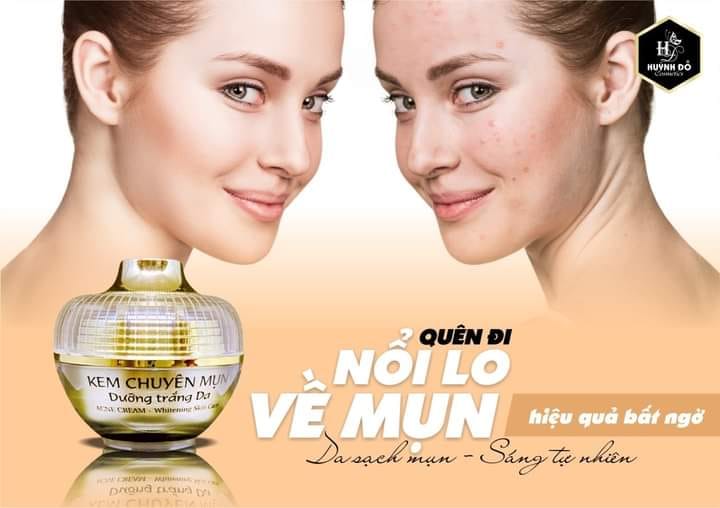 Kem Face Chuyên Mụn Trắng Da Huỳnh Đỗ