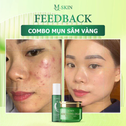 Combo Cao Mụn Sâm Vàng MQ Skin chính hãng
