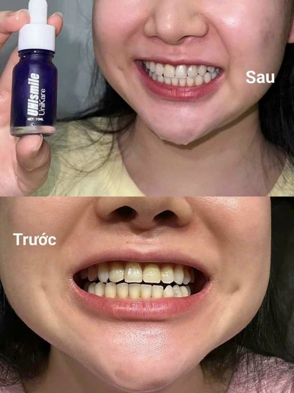 Serum Trắng Răng Unismile, Hỗ Trợ Cải Thiện Vết Ố Vàng Unikare
