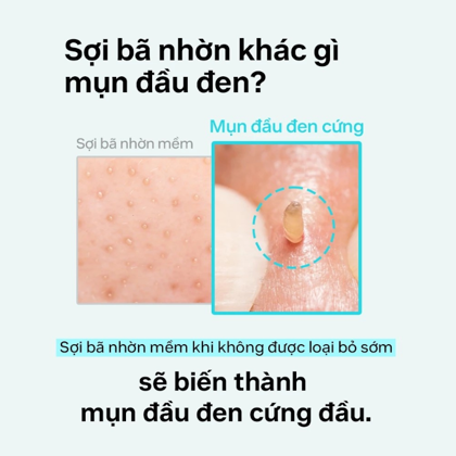 Ủ Mụn ilso Super Melting Sebum Softener 150g