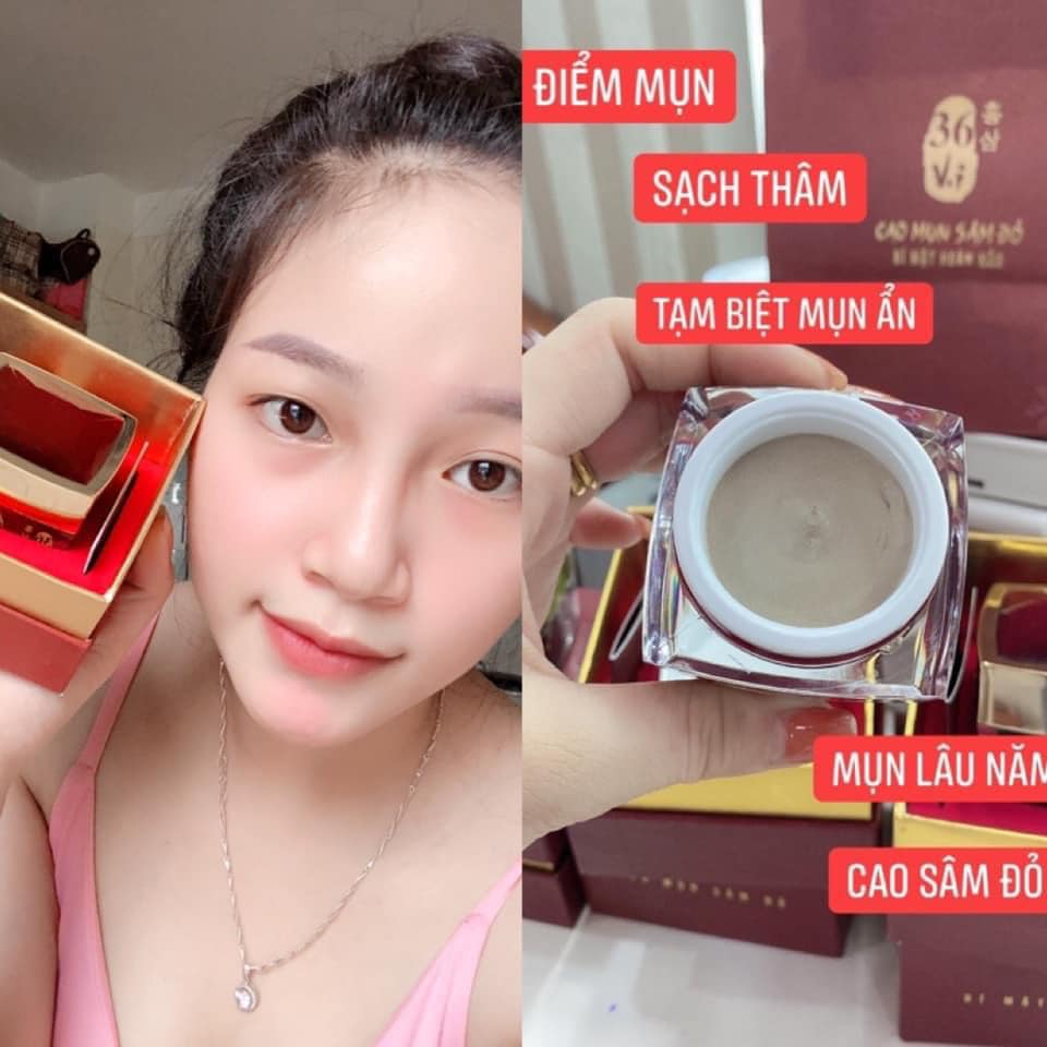CAO MỤN SÂM ĐỎ - dòng kem trị mụn không tìm ra khuyết điểm