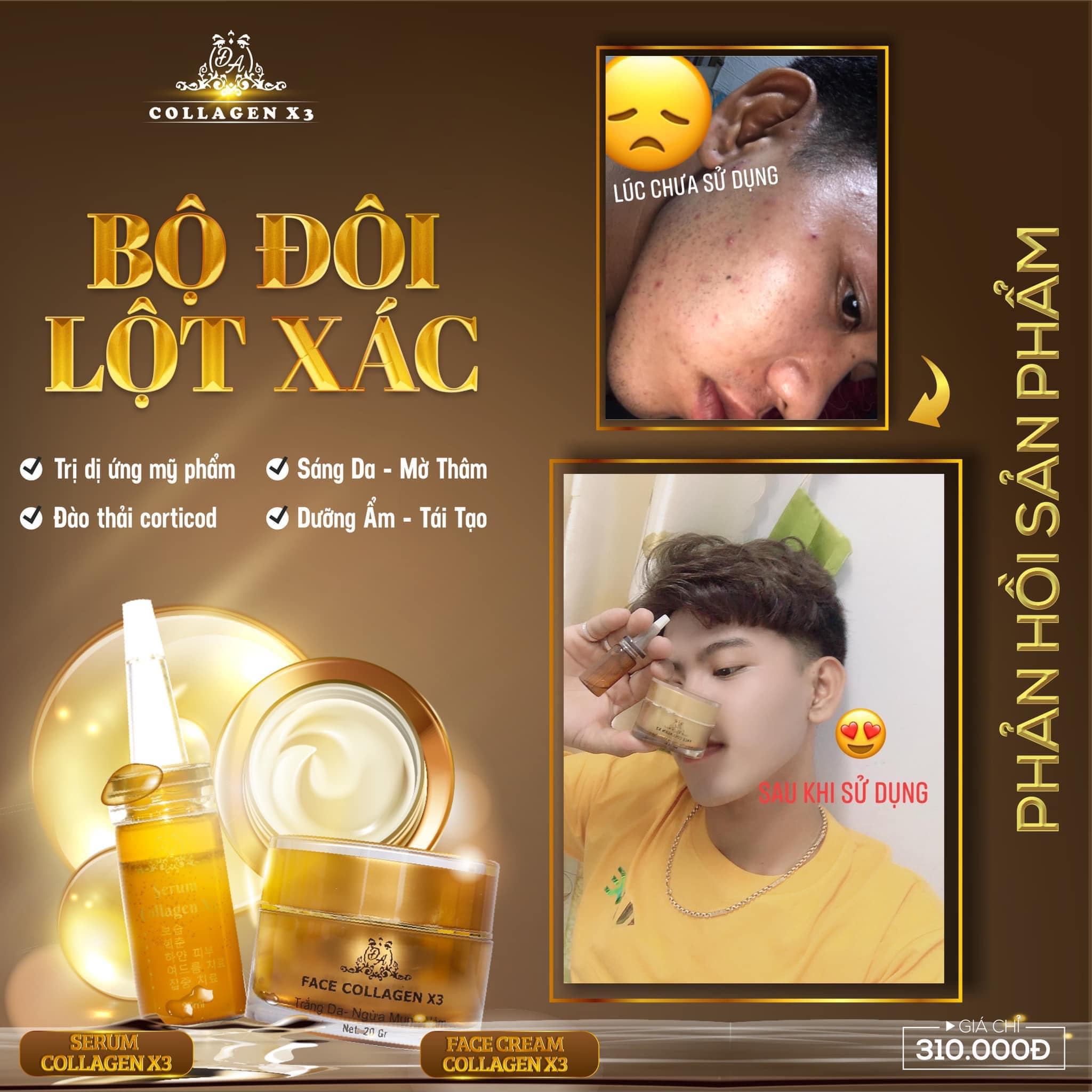 Combo Duỡng Da Trị Nám + Chống nắng Nọc Ong Collagen X3