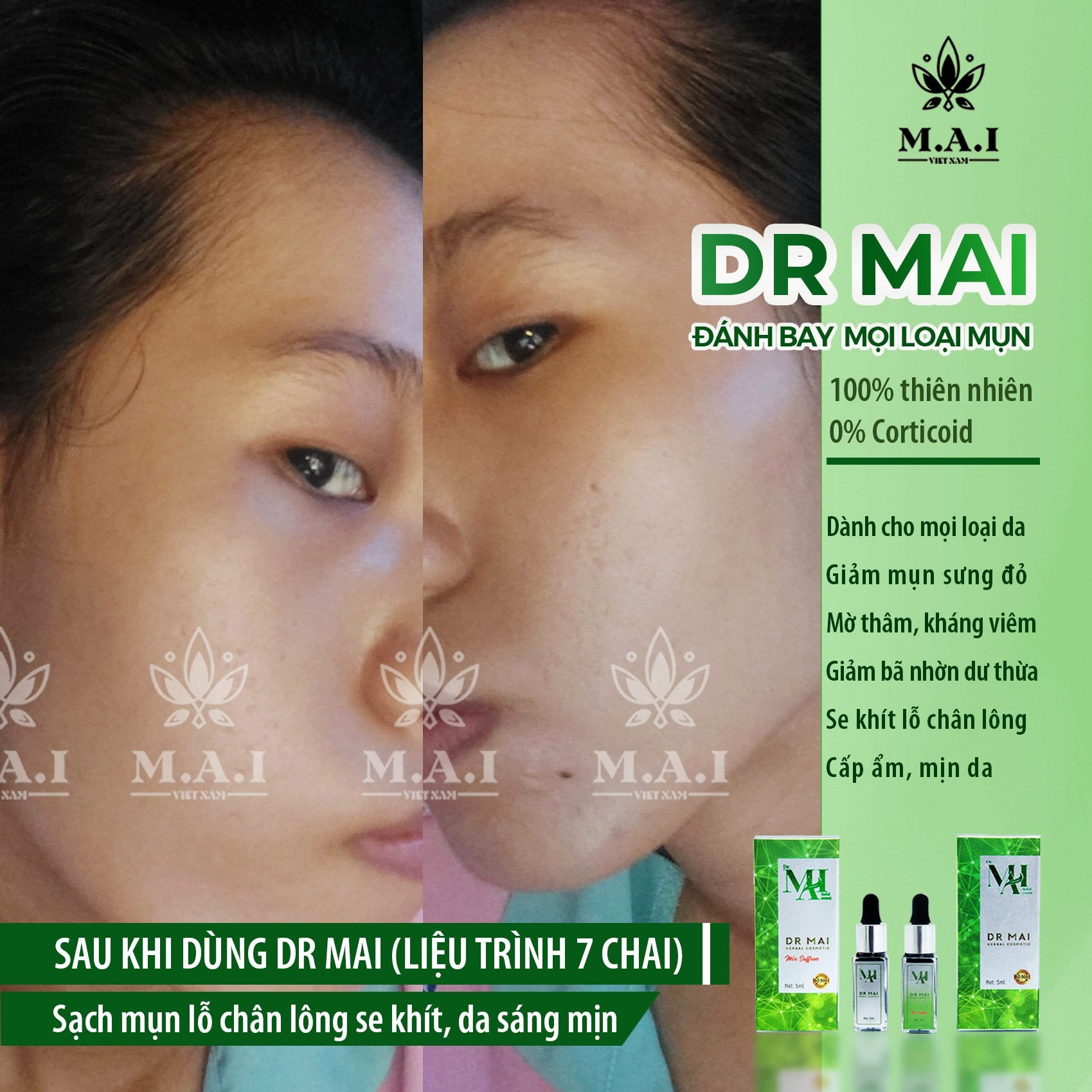Sử dụng DR Mai mụn ơi ! tiễn lun