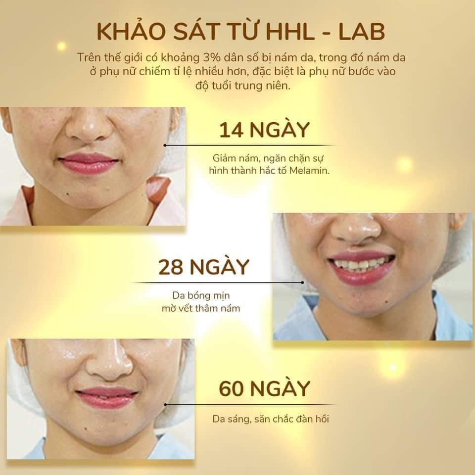 Nâng Niu Và Chăm Sóc Da Với Kem Dưỡng Huyết Yến Phục Hồi KB One