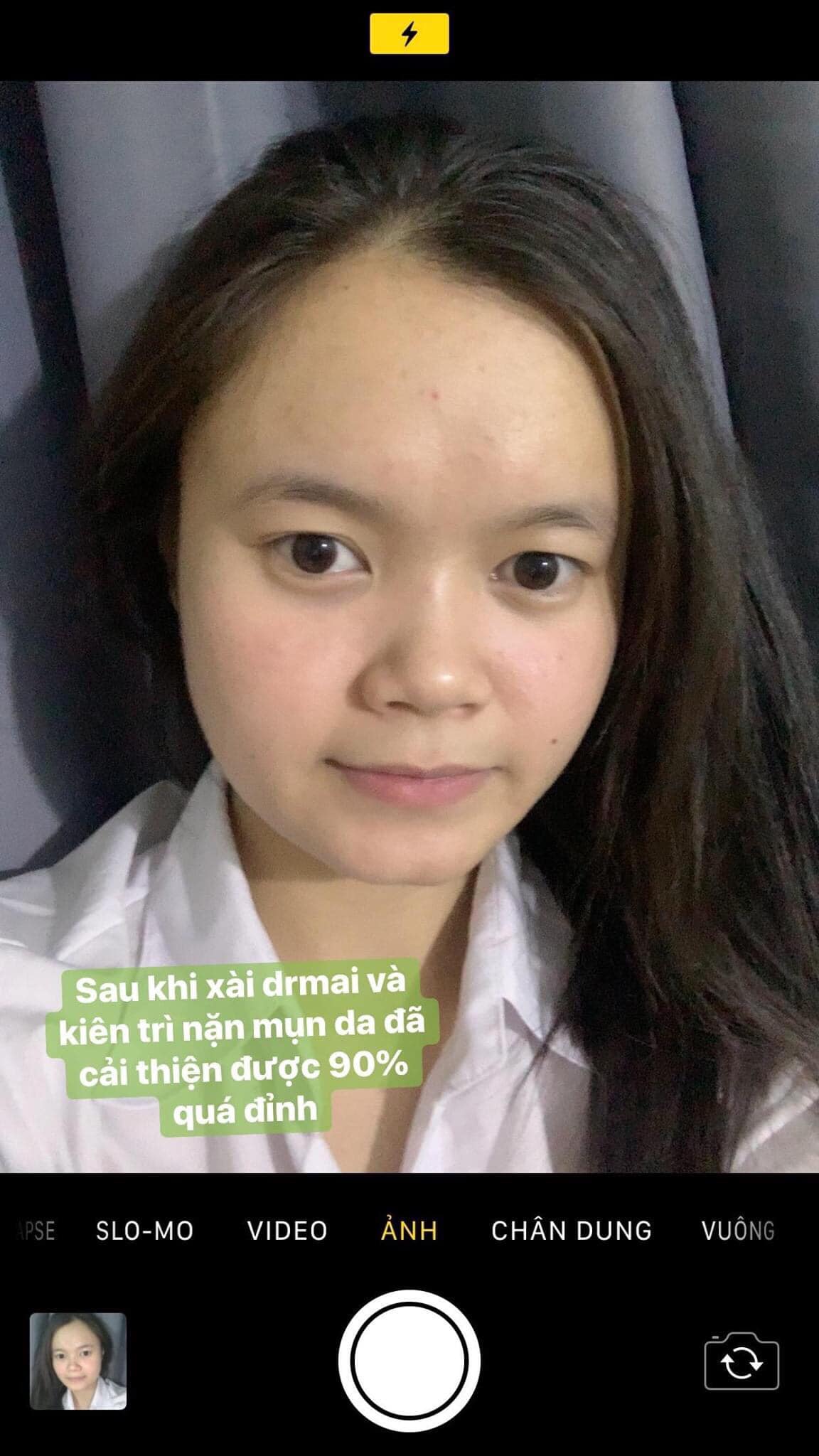 Phụ nữ muốn đẹp phải siêng, đừng lười biếng để mặt đầy mụn