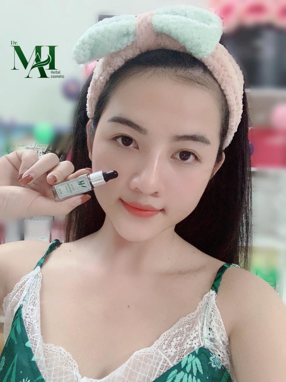 Đây là lý do tại sao bạn nên dùng Dr Mai trị mụn