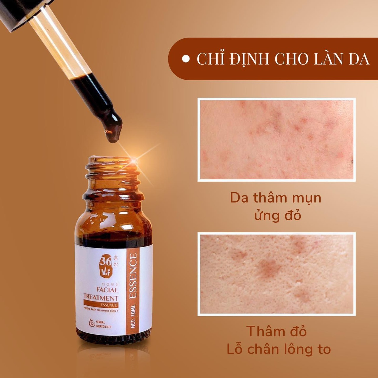 Vì sao ta nên chọn Cốt Huyết Thanh Thảo Dược