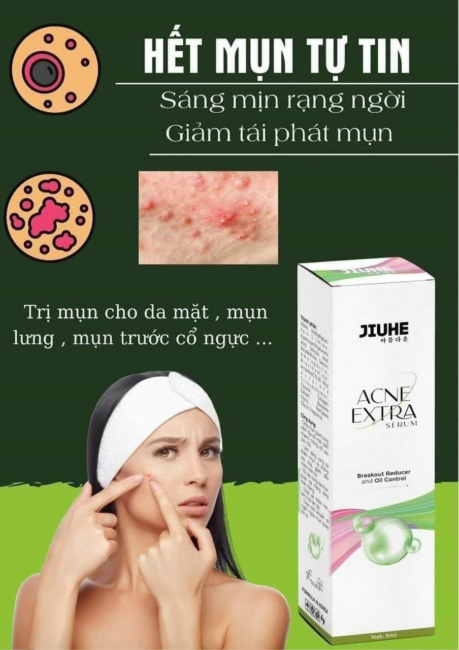 Sạch mụn liền tay có ngay Jiuhe Acne Extra