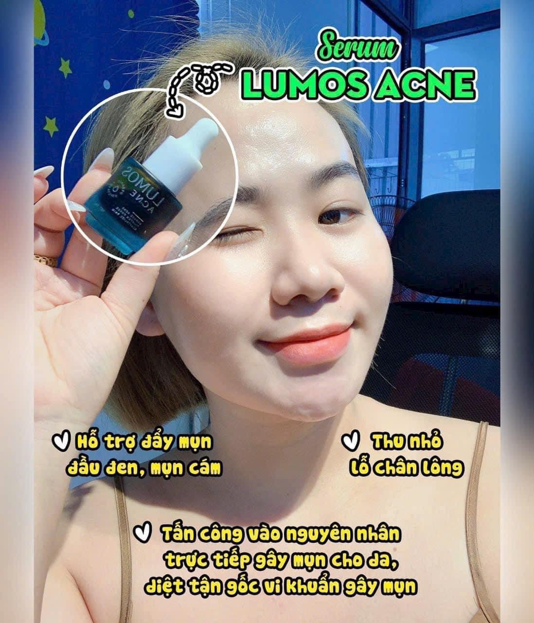 Lumos Acne giúp da tìm lại phiên bản hoàn hảo nhất mụn vết thâm nám da sẹo rỗ