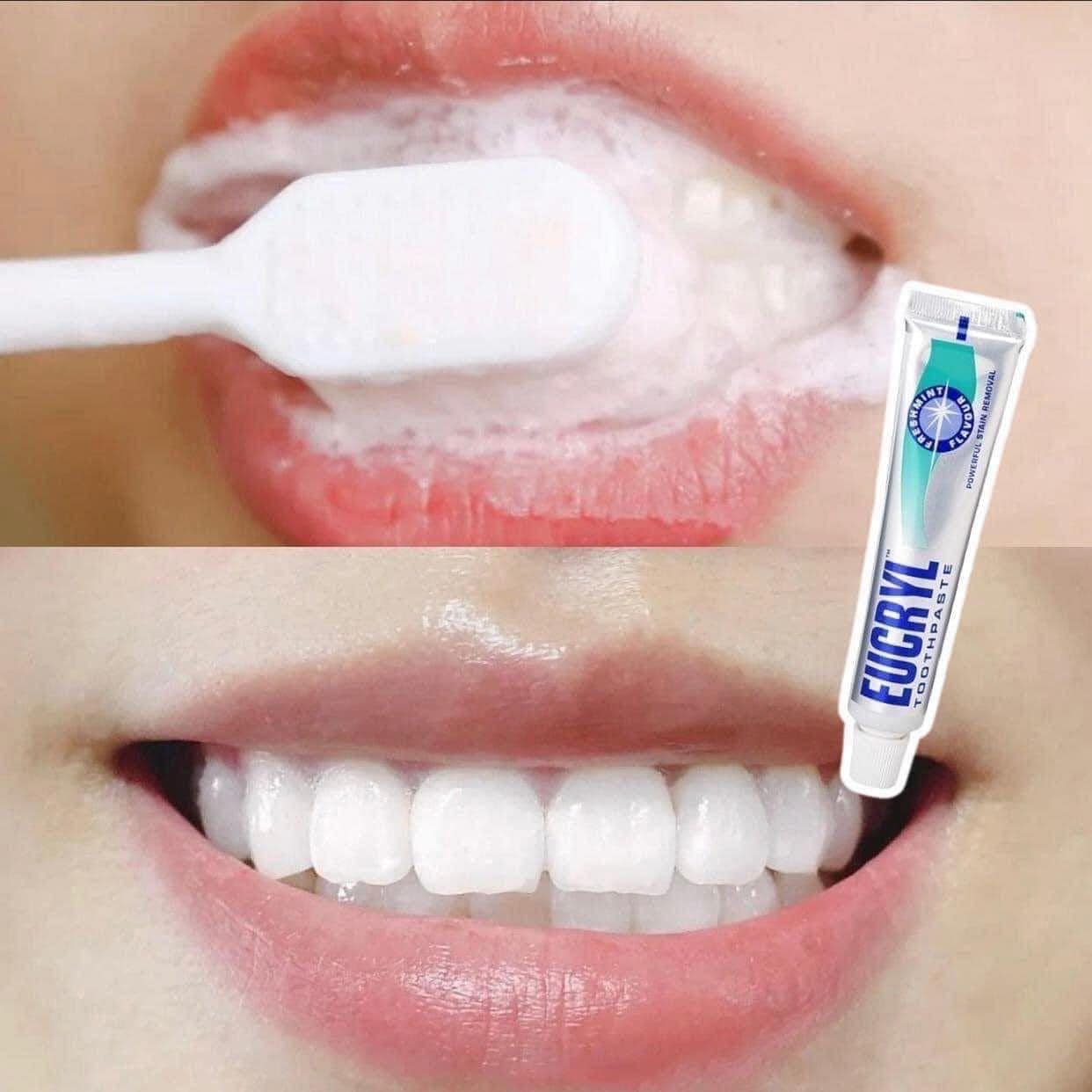 Kem Đánh Răng Giảm Hôi Miệng Eucryl Toothpaste 50ml Của Anh