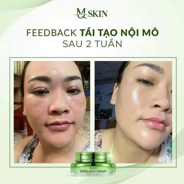 Kem Face Tái Tạo Nội Sinh Exfoliant Cream MQ Skin Tặng Kem Dưỡng HA