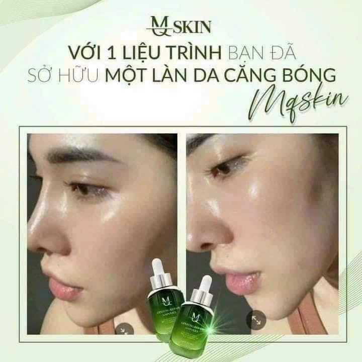 Phù phép làn da căng mịn chuẩn Hàn Quốc với Serum Căng Bóng Da MQ Skin